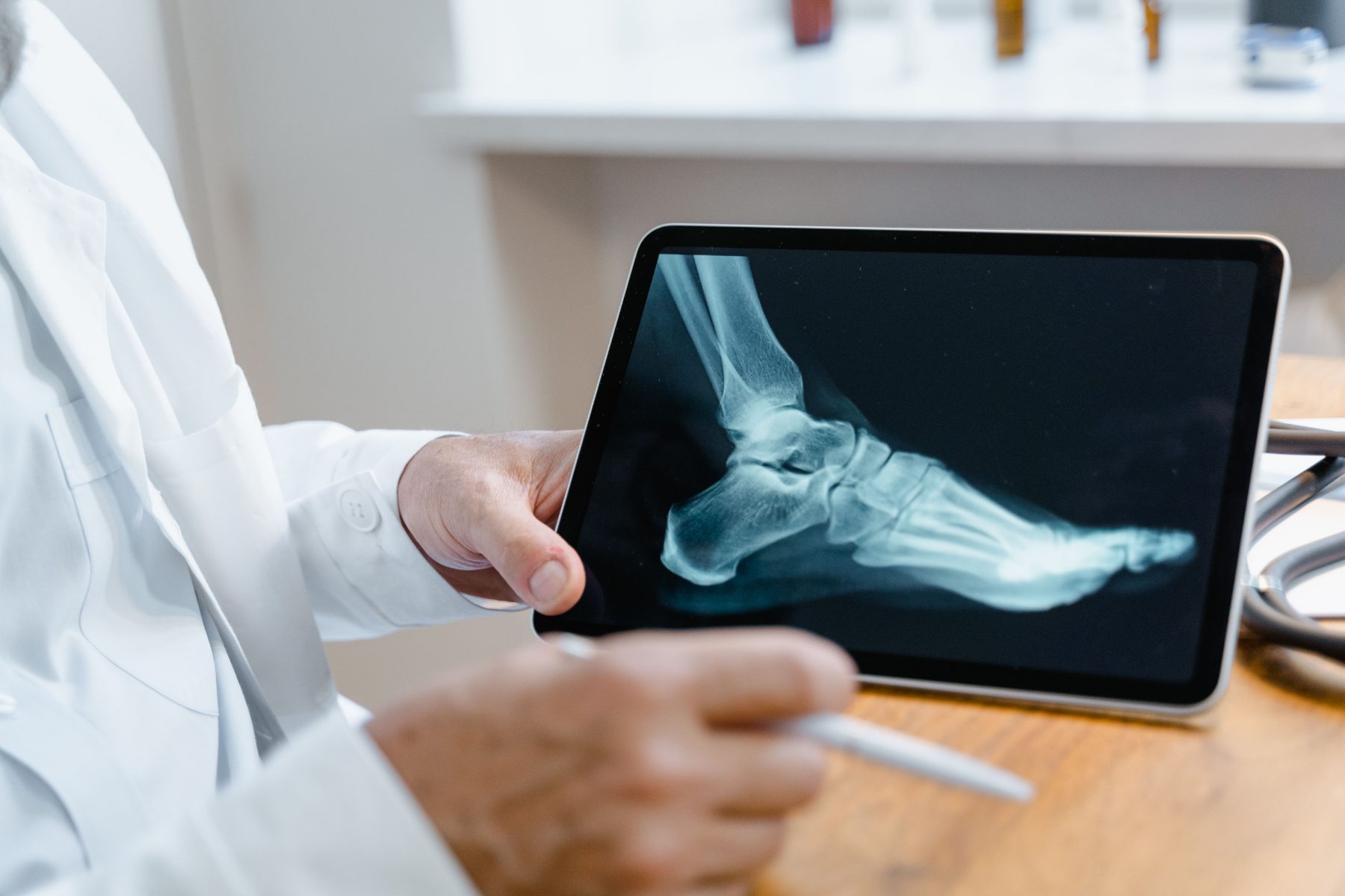 Radiografía de pie en consulta
